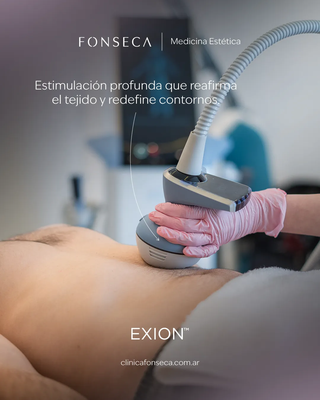 Exion-02