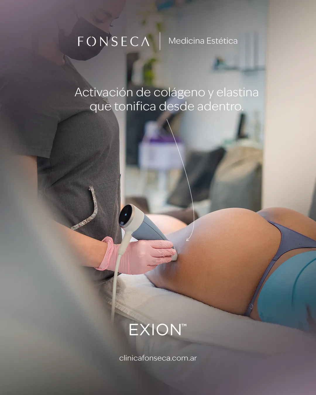 Exion-03