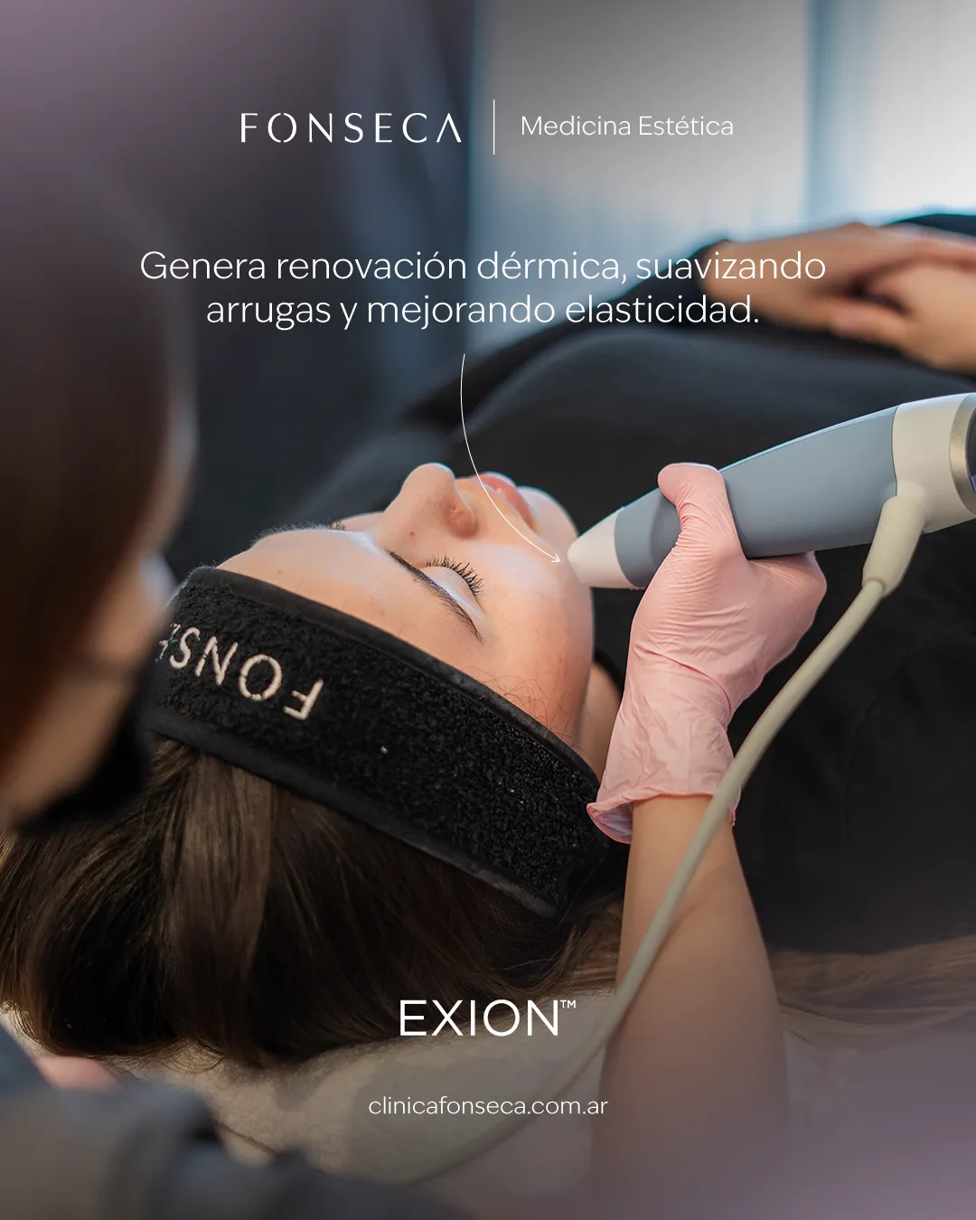 Exion-04
