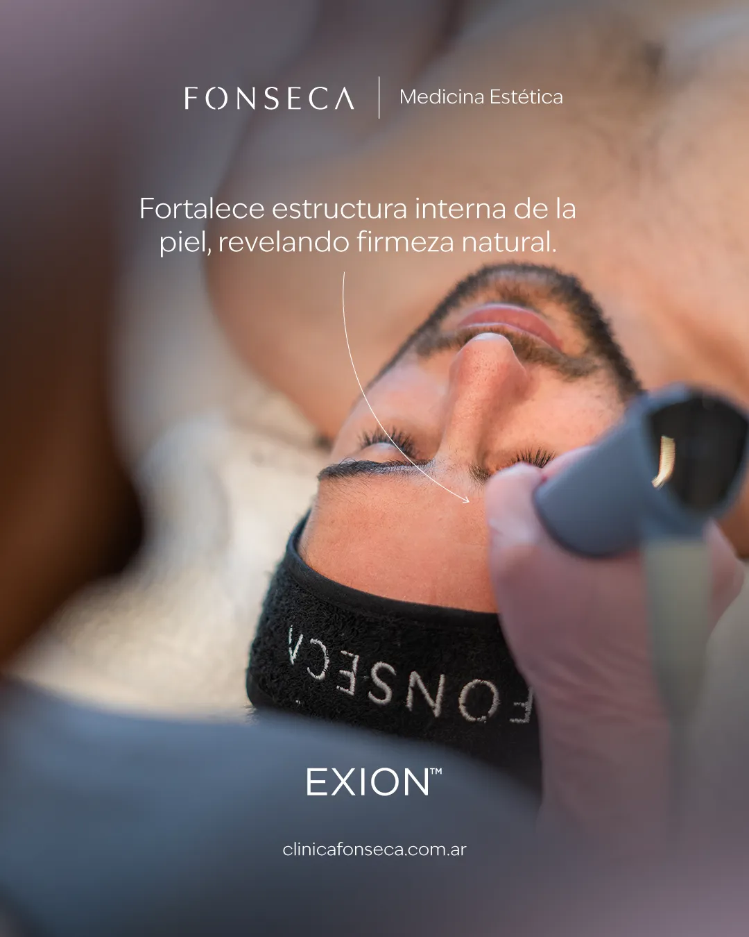 Exion-05